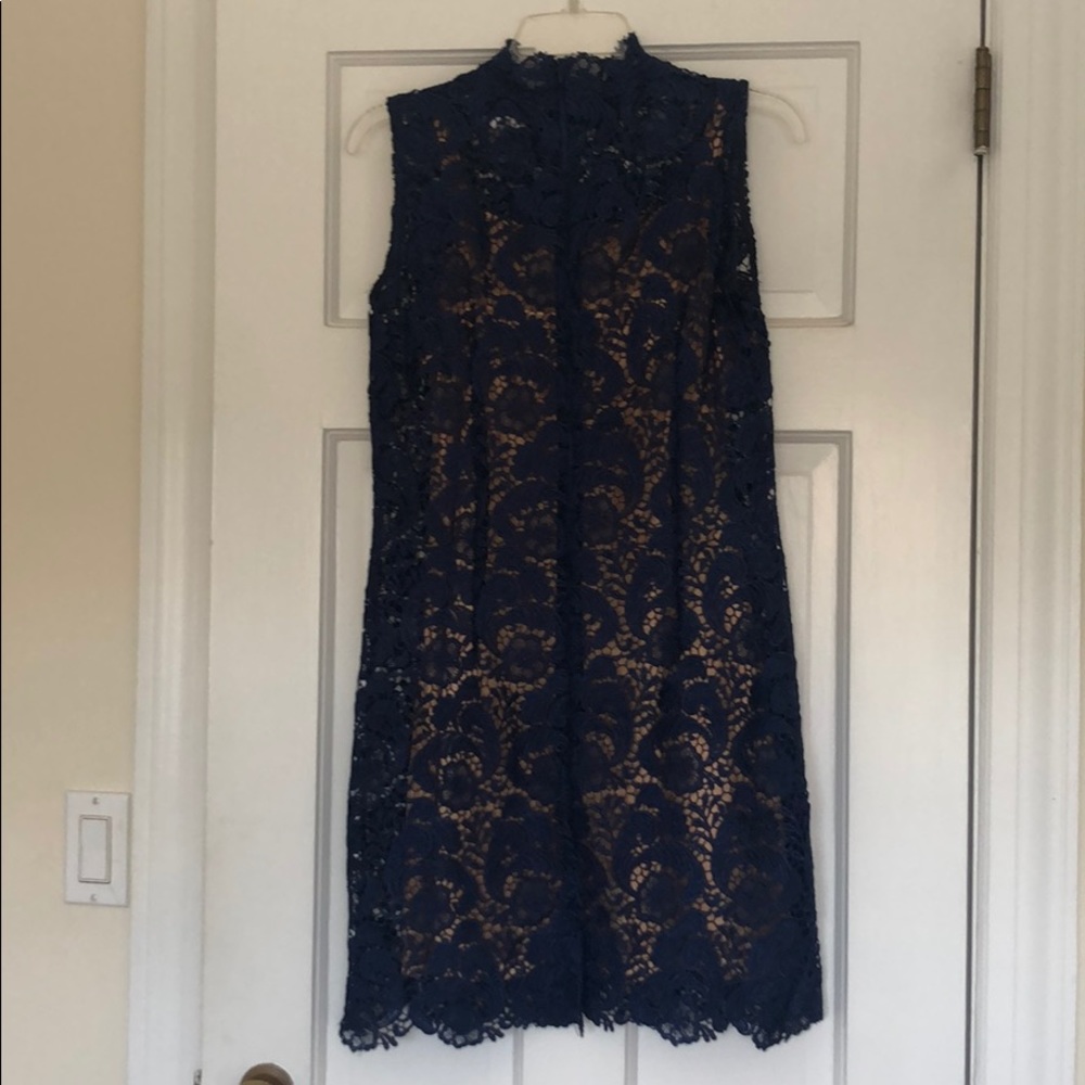LACE DRESS 💙 - Picture 5 of 6